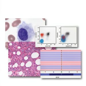 Hematology Pathology Kindle Edition Wolters Kluwer Health-0