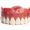 Temporary Immediate Upper Denture Jesse Denture Boil and Bite-0