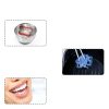 Veneers Teeth Tooth Replacement Kit TOWAVE Adjustable Comfort-3
