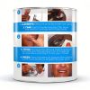 Temporary Immediate Upper Denture Jesse Denture Boil and Bite-1
