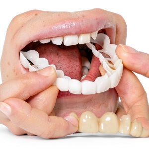 Temporary Smile Solutions YZINSIGHT Pair Natural Top Bottom Adjustable-0