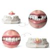 Smile Seek Removable Dentures - Natural Clip In Tooth (1 Tooth)-3