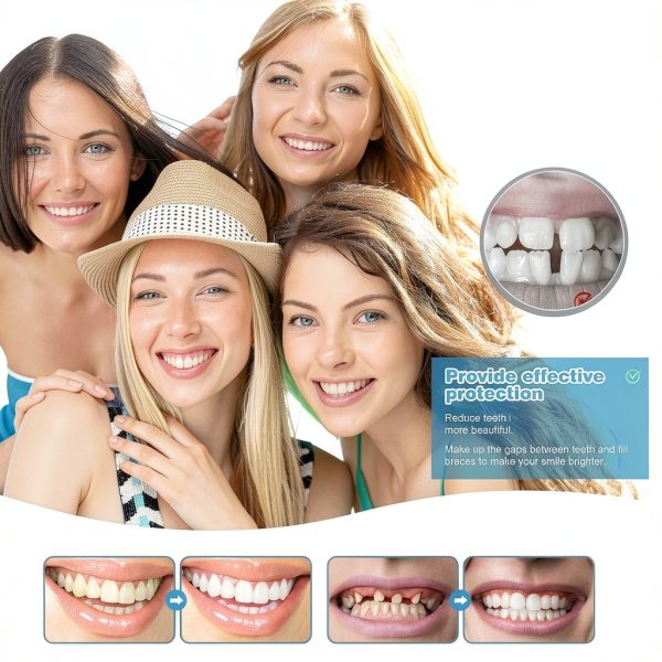 Veneers Teeth for Women and Men by TOWAVE - Natural Comfortable Kit(1)-2