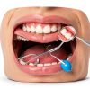 Provisional Tooth Kit DIY Thermal Beads 1 Fl Oz Dental Fix-1