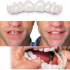 Temporary Smile Solutions YZINSIGHT Pair Natural Top Bottom Adjustable-3