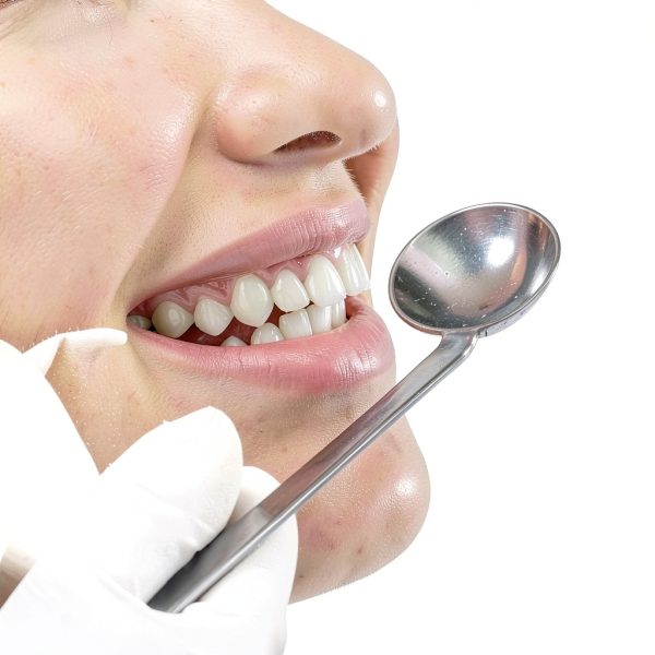 Temporary Veneers Kit Treayes Natural Comfortable Fit Men Women-2