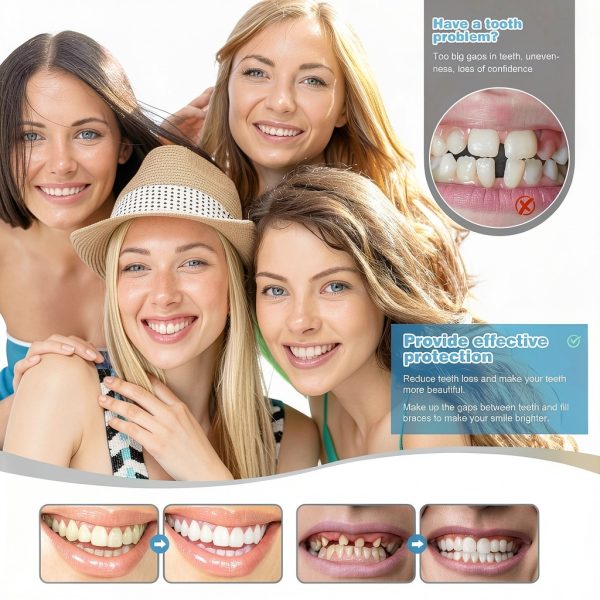Veneers Teeth for Women and Men, Tooth Replacement Kit, Nature and Comfortable-2