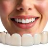 Temporary Smile Support Adjustable LEOONER 2 Pairs Provisional Crown-7