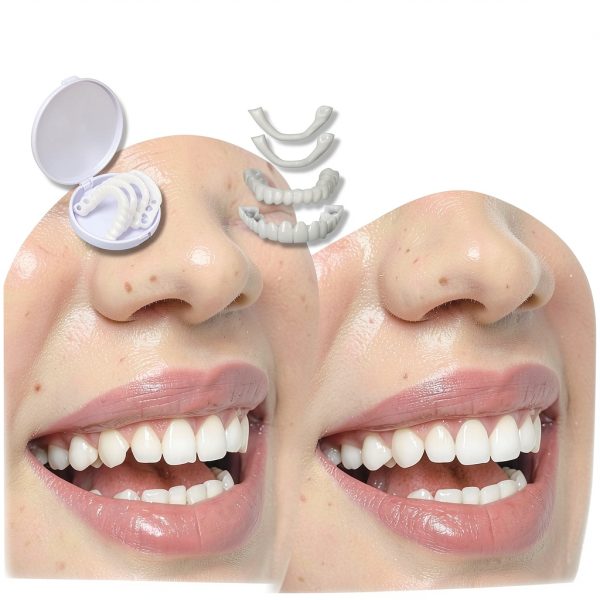 Temporary Veneers Kit Baxozud DD01 Natural Comfortable Tooth-4