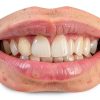 Temporary Veneers Kit TOWAVE Pair – Natural Look, Custom Fit-2
