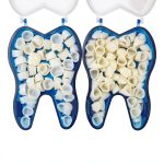 Dental Teeth Temporary Crown Kit Oral Teeth Whitening Protecting Molar Veneers Front & Molar Posterior(2 Boxes)-0