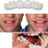 Temporary Veneers Kit TOWAVE Pair – Natural Look, Custom Fit-3