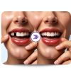 DIY Tooth Provisional Kit by Three Wood Thermal Beads - White 1 Fl Oz-5